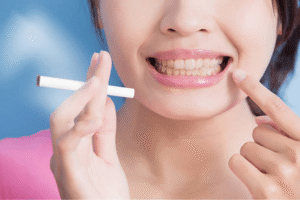 bad-oral-health