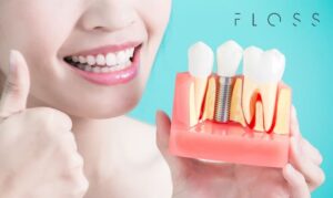 dental-implant