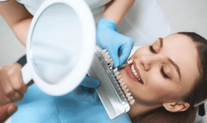 dental veneers magnolia