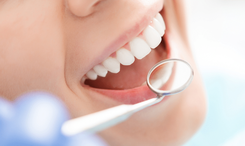 Benefits of Teeth Whitening Services