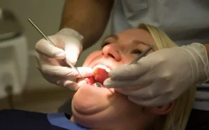 A Comprehensive Guide to Dentures