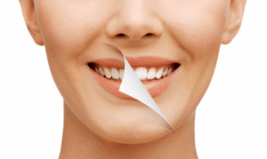 How Long After Teeth Whitening Can I Drink Alcohol