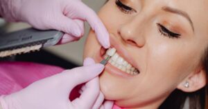 tips for caring for your veneers to ensure their longevity