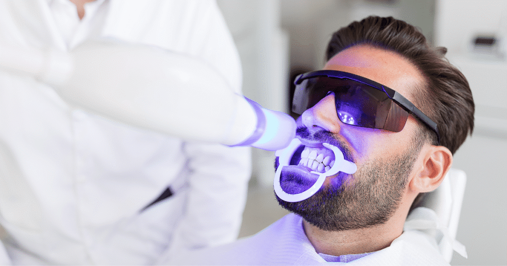 How Often Should You Whiten Your Teeth