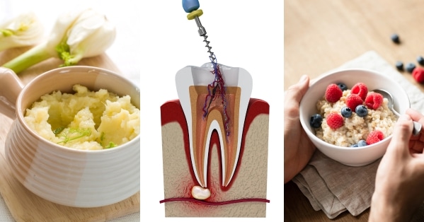 role of nutrition in root canal recovery for residents of magnolia